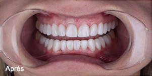 résultat soins dentaires